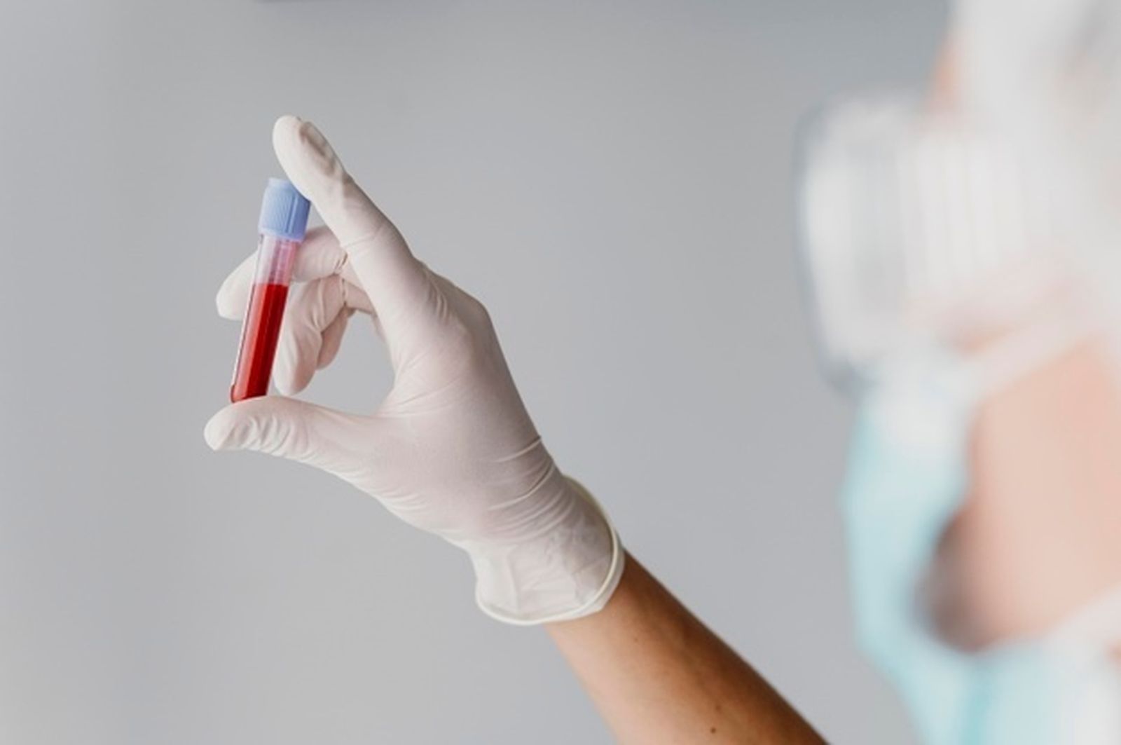 ¿Tienes hierro bajo aunque no tengas anemia? La nueva guía médica cambia el umbral
